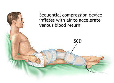 DVT Example 2